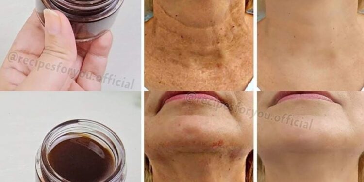 Magisches Anti-Aging-Öl: Kaffeeöl, das Falten glättet und stärker ist als Botox!