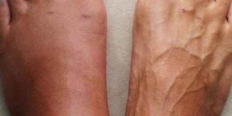 Hier sind die 6 Symptome