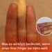 Was es wirklich bedeutet, wenn einer deiner Finger weiß wird, wenn es kalt ist