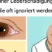 5 frühe Anzeichen einer Leberschädigung, die Sie niemals ignorieren sollten