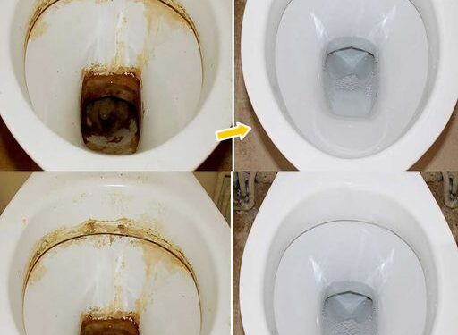 Verkrustungen in der Toilette: Sie haben bereits den stärksten Entkalker zu Hause und das ganz natürlich!