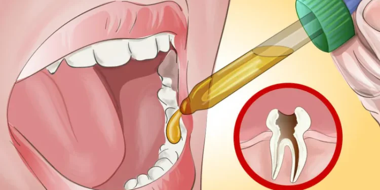 Natürliche Heilmittel gegen Zahnschmerzen, die Ihr Zahnarzt Ihnen nicht verraten möchte
