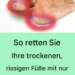 So retten Sie Ihre trockenen, rissigen Füße mit nur einer Zutat!