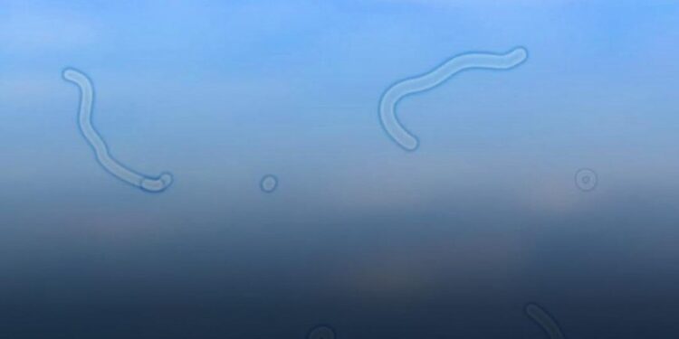 Was sind Mouches volantes? Das sollten Sie tun, wenn Sie sie sehen