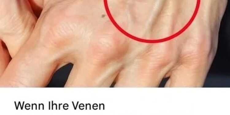 Wenn Sie sichtbare Venen haben, bedeutet das, dass Sie