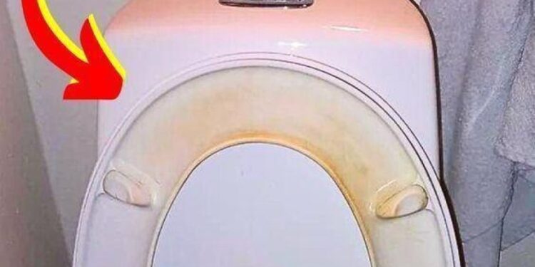 Der Trick, um gelbe Flecken auf dem WC-Sitz zu entfernen