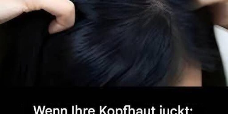 Juckreiz am Kopf? Das sind die Hauptursachen.