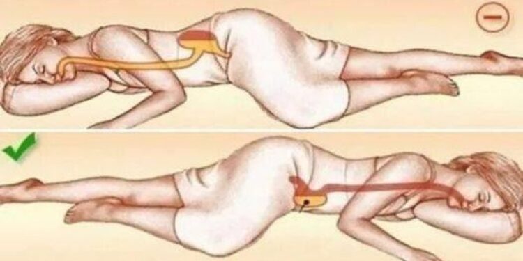 Das Schlafen auf der linken Seite beeinträchtigt Ihre Gesundheit auf eine Art und Weise, die Sie nie für möglich gehalten hätten