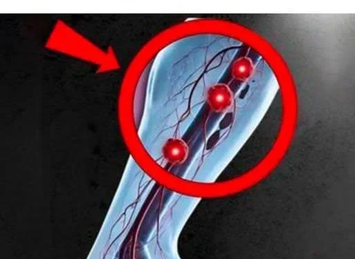 Die 6 besten Öle zur natürlichen Auflösung von Blutgerinnseln