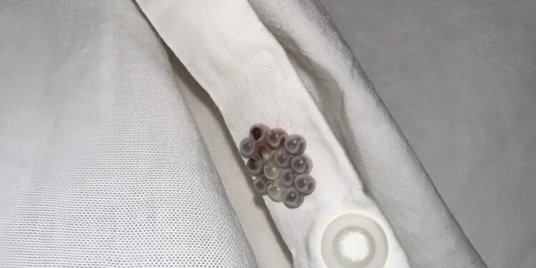 Ich habe diese kleinen Murmeln in meinem Bett gefunden und hätte fast einen Herzinfarkt bekommen: Ich verrate Ihnen, was es war.