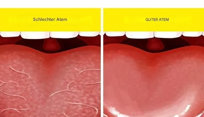 6 Möglichkeiten, Mundgeruch auch nach dem Aufwachen zu vermeiden
