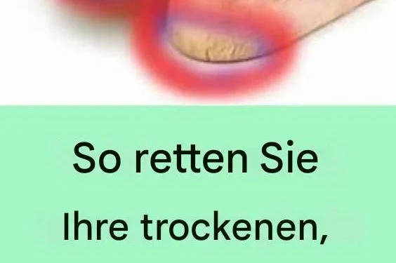 So retten Sie Ihre trockenen, rissigen Füße mit nur einer Zutat!