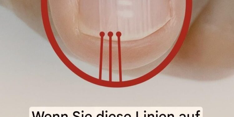 Wenn nach 40 Jahren Falten auf Ihren Nägeln erscheinen, könnte dies ein Warnzeichen sein