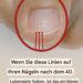 Wenn nach 40 Jahren Falten auf Ihren Nägeln erscheinen, könnte dies ein Warnzeichen sein