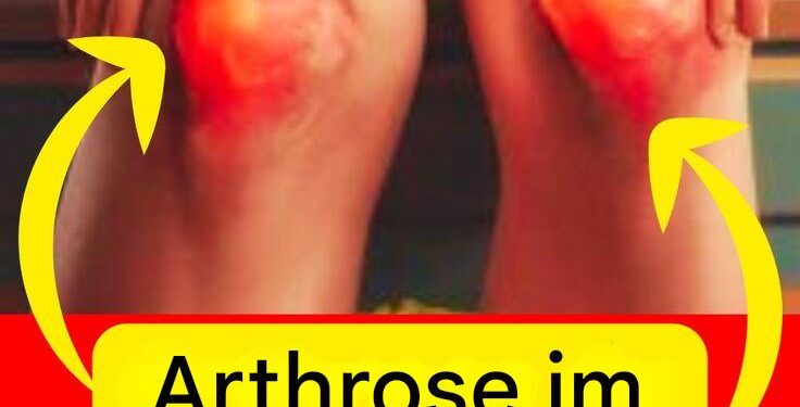 Entlasten Sie Ihre Knie sanft: 10 Tipps, die von Gesundheitsexperten validiert wurden