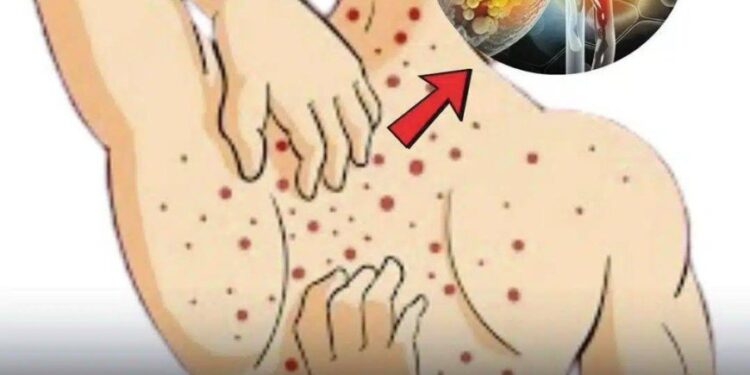 Fettlebererkrankung (Steatose): Ursachen, Symptome, Behandlung und Hausmittel