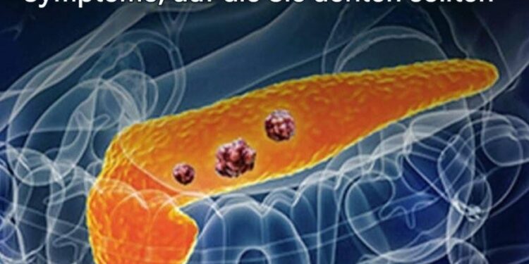 10 Anzeichen von Bauchspeicheldrüsenkrebs, die Sie nicht ignorieren sollten