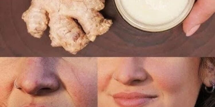 Eine natürliche Alternative zu Botox zur Faltenreduzierung