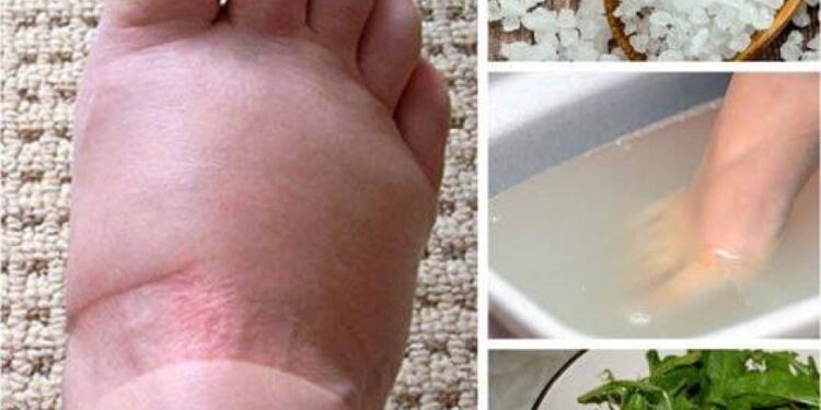 Hausmittel gegen geschwollene Füße