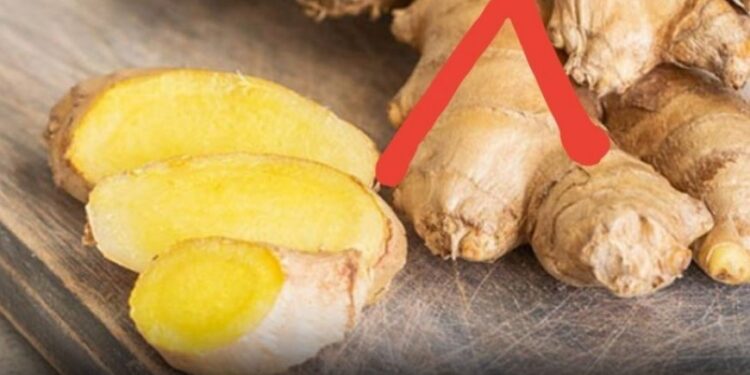 Vermeiden Sie Ingwer, wenn Sie an diesen 5 Gesundheitsproblemen leiden.