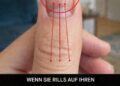 Linien auf Ihren Fingernägeln: Was sie über Ihre Gesundheit verraten könnten
