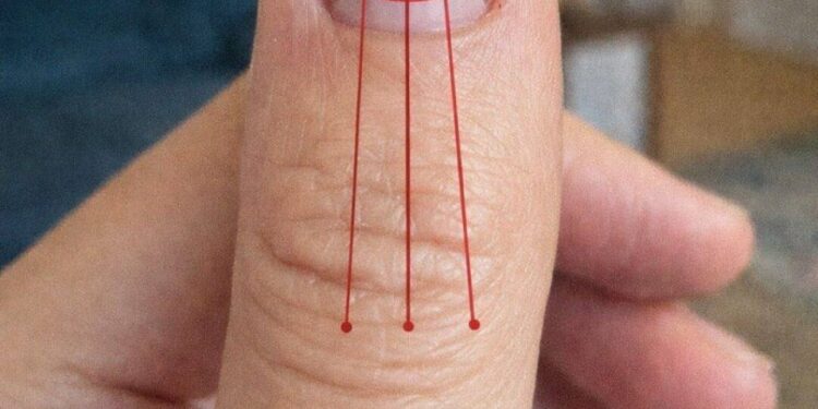 Linien auf Ihren Fingernägeln: Was sie über Ihre Gesundheit verraten könnten