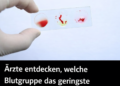 Ärzte haben herausgefunden, welche Blutgruppe das geringste Krebsrisiko birgt.