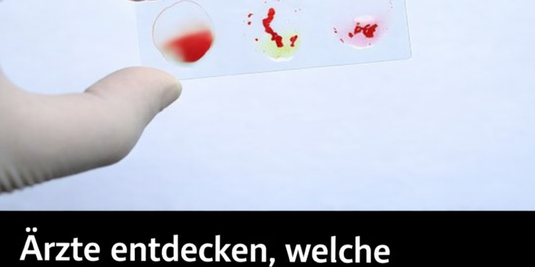 Ärzte haben herausgefunden, welche Blutgruppe das geringste Krebsrisiko birgt.