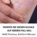 Werfen Sie die Schale dieser Frucht nicht weg: Sie hilft bei der Behandlung von Schuppenflechte, entfernt Warzen und hellt die Zähne auf!