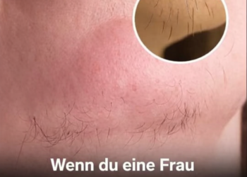 Wenn du eine Frau mit Kinnhaaren bist, bedeutet das Folgendes
