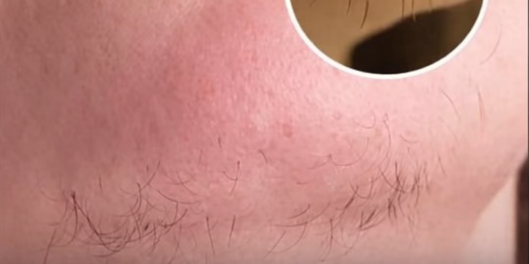 Wenn du eine Frau mit Kinnhaaren bist, bedeutet das Folgendes