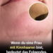Wenn du eine Frau mit Kinnhaaren bist, bedeutet das Folgendes