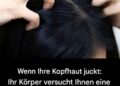 Juckreiz am Kopf? Das sind die Hauptursachen.
